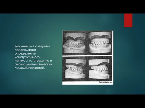 . Дальнейший алгоритм предполагает определение конструктивного прикуса, изготовление и анализ диагностических моделей челюстей,