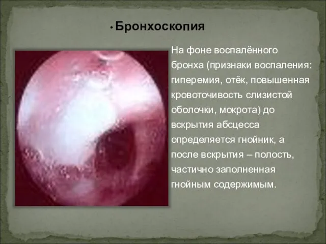 На фоне воспалённого бронха (признаки воспаления: гиперемия, отёк, повышенная кровоточивость слизистой