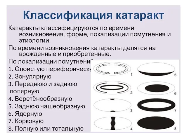 Классификация катаракт Катаракты классифицируются по времени возникновения, форме, локализации помутнения и