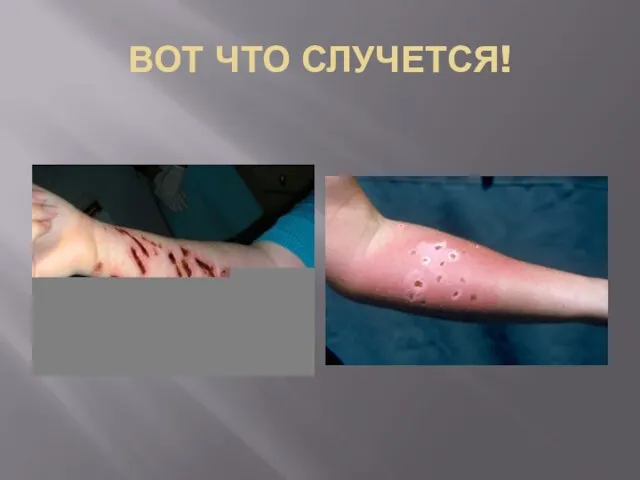 ВОТ ЧТО СЛУЧЕТСЯ!