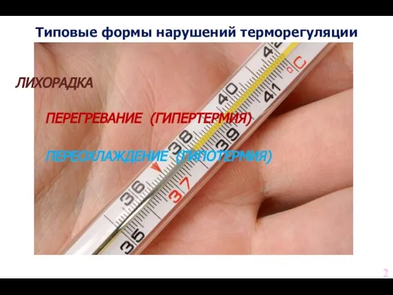 Типовые формы нарушений терморегуляции ЛИХОРАДКА ПЕРЕГРЕВАНИЕ (ГИПЕРТЕРМИЯ) ПЕРЕОХЛАЖДЕНИЕ (ГИПОТЕРМИЯ) 2