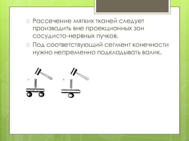 Рассечение мягких тканей следует производить вне проекционных зон сосудисто-нервных пучков. Под