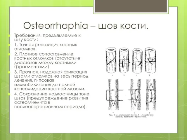 Osteorrhaphia – шов кости. Требования, предъявляемые к шву кости: 1. Точная