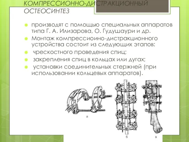 КОМПРЕССИОННО-ДИСТРАКЦИОННЫЙ ОСТЕОСИНТЕЗ производят с помощью специальных аппаратов типа Г. А. Илизарова,