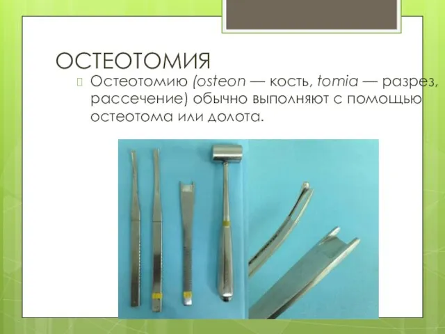 ОСТЕОТОМИЯ Остеотомию (osteon — кость, tomia — разрез, рассечение) обычно вы­полняют с помощью остеотома или долота.