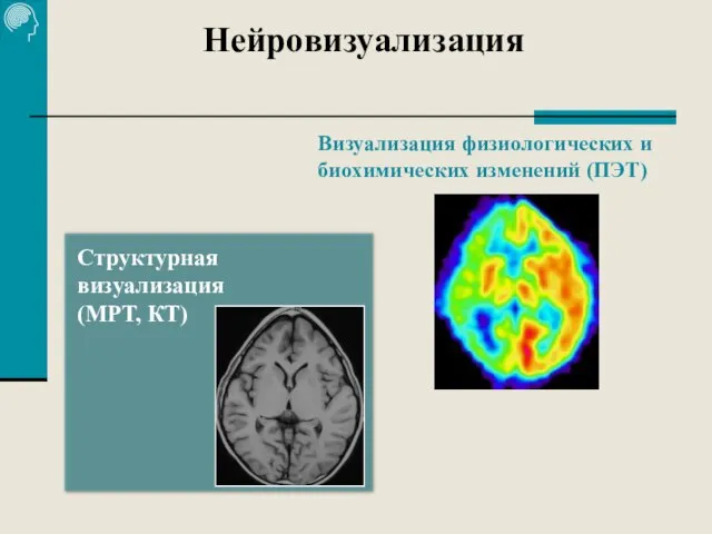 Нейровизуализация Визуализация физиологических и биохимических изменений (ПЭТ) Структурная визуализация (МРТ, КТ)