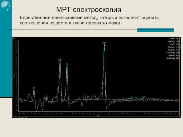 МРТ-спектроскопия Единственный неинвазивный метод, который позволяет оценить соотношения веществ в ткани головного мозга.