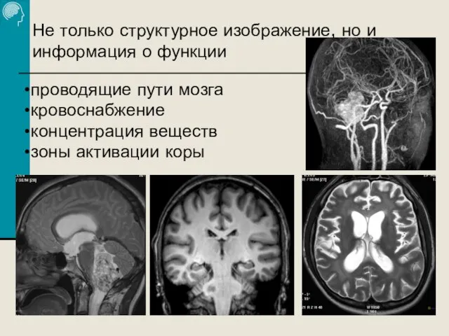 Не только структурное изображение, но и информация о функции проводящие пути