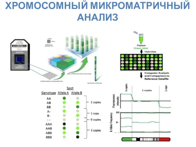 ХРОМОСОМНЫЙ МИКРОМАТРИЧНЫЙ АНАЛИЗ