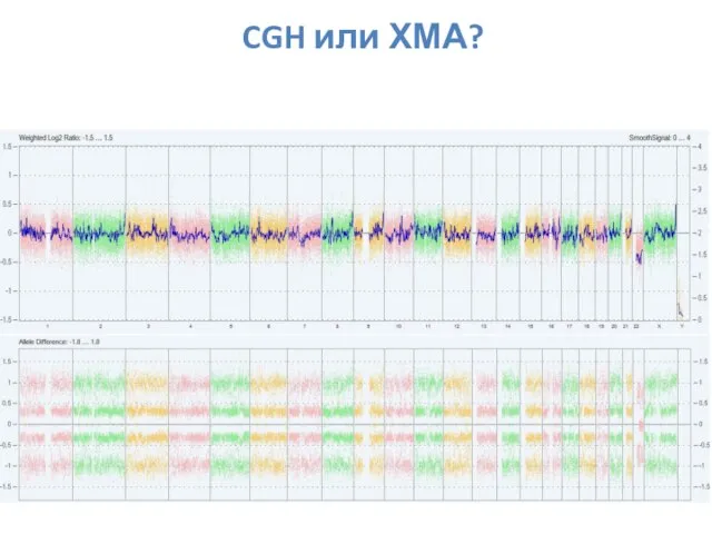 CGH или ХМА?