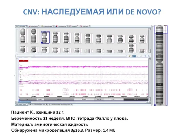 CNV: НАСЛЕДУЕМАЯ ИЛИ DE NOVO? ХРОМОСОМНЫЙ МИКРОМАТРИЧНЫЙ АНАЛИЗ ПОЗВОЛЯЕТ ВЫЯВЛЯТЬ МИКРОДЕЛЕЦИИ…