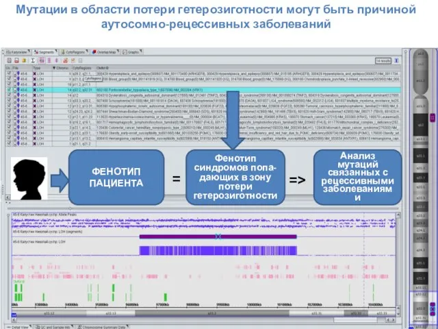 ФЕНОТИП ПАЦИЕНТА Фенотип синдромов попа-дающих в зону потери гетерозиготности = =>