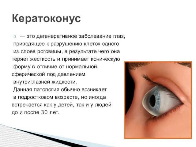 — это дегенеративное заболевание глаз, приводящее к разрушению клеток одного из