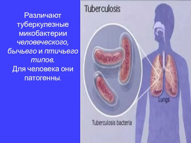 Различают туберкулезные микобактерии человеческого, бычьего и птичьего типов. Для человека они патогенны.