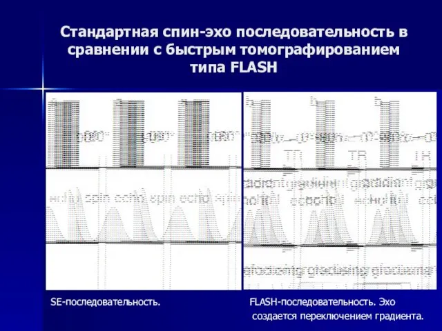 Стандартная спин-эхо последовательность в сравнении с быстрым томографированием типа FLASH SE-последовательность. FLASH-последовательность. Эхо создается переключением градиента.