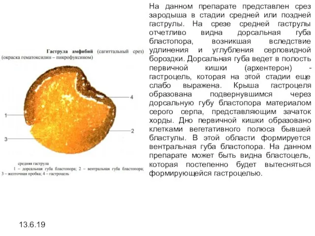 13.6.19 На данном препарате представлен срез зародыша в стадии средней или