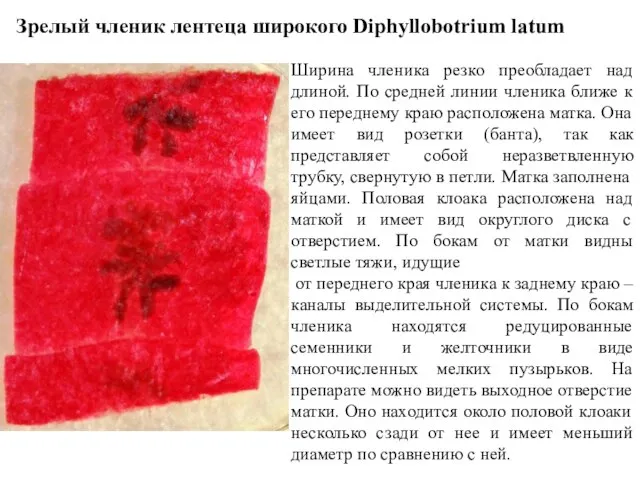 Зрелый членик лентеца широкого Diphyllobotrium latum Ширина членика резко преобладает над