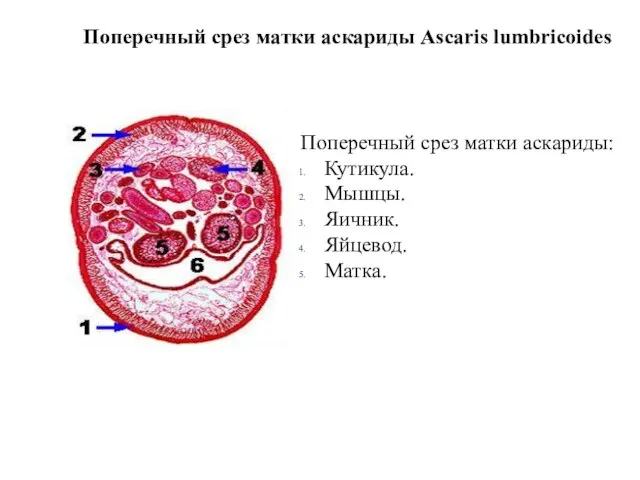 Поперечный срез матки аскариды: Кутикула. Мышцы. Яичник. Яйцевод. Матка. Поперечный срез матки аскариды Ascaris lumbricoides