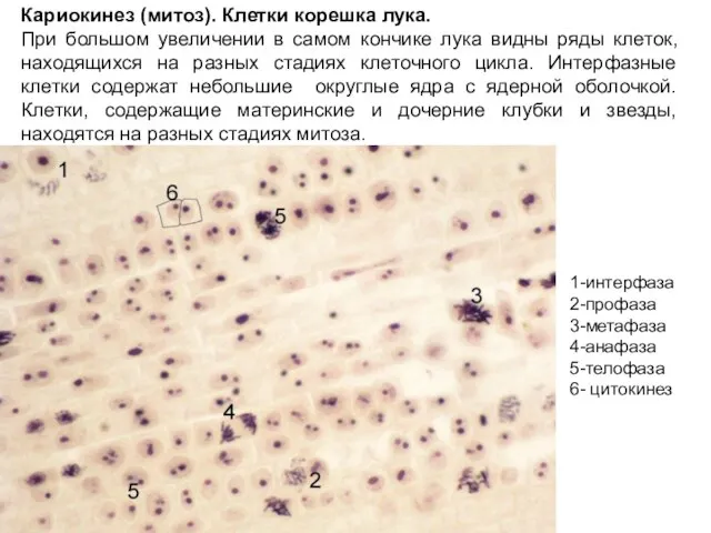 Кариокинез (митоз). Клетки корешка лука. При большом увеличении в самом кончике