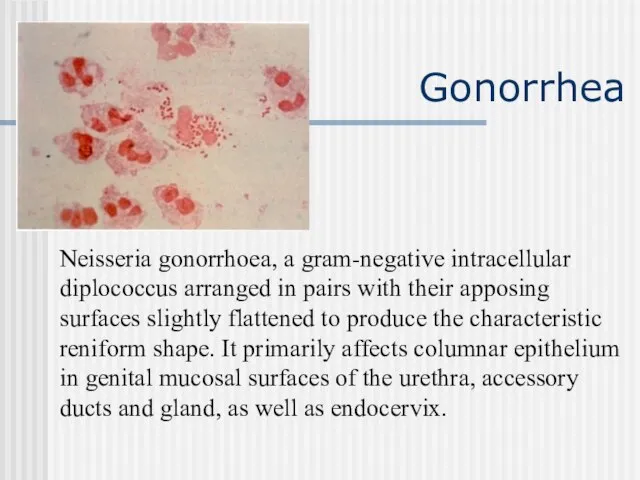 Gonorrhea Neisseria gonorrhoea, a gram-negative intracellular diplococcus arranged in pairs with