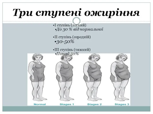 Три ступені ожиріння І ступінь (легкий) До 30 % від нормальної