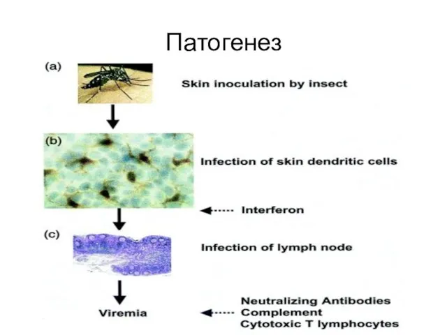 Патогенез