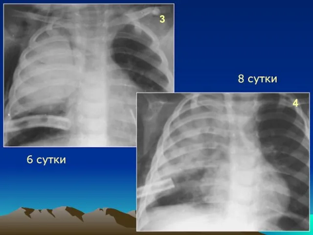 3 4 6 сутки 8 сутки