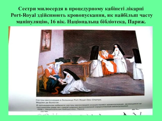 Сестри милосердя в процедурному кабінеті лікарні Port-Royal здійснюють кровопускання, як найбільш