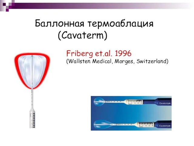 Баллонная термоаблация (Cavaterm) Friberg et.al. 1996 (Wallsten Medical, Morges, Switzerland)