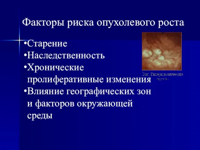 Факторы риска опухолевого роста Старение Наследственность Хронические пролиферативные изменения Влияние географических зон и факторов окружающей среды