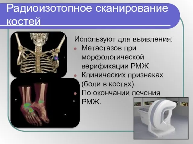 Радиоизотопное сканирование костей Используют для выявления: Метастазов при морфологической верификации РМЖ