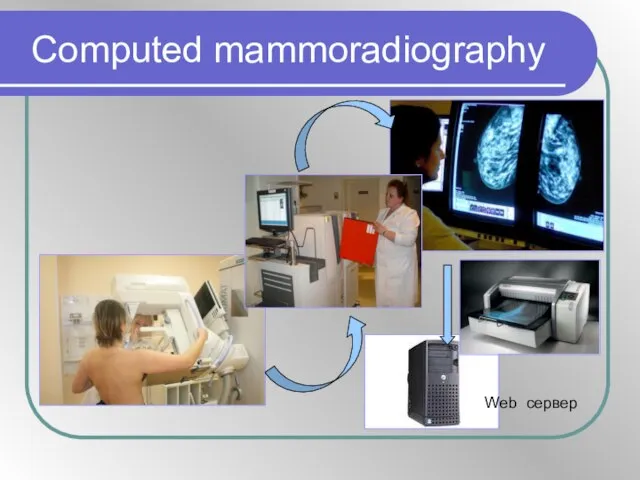 Computed mammoradiography Web cервер