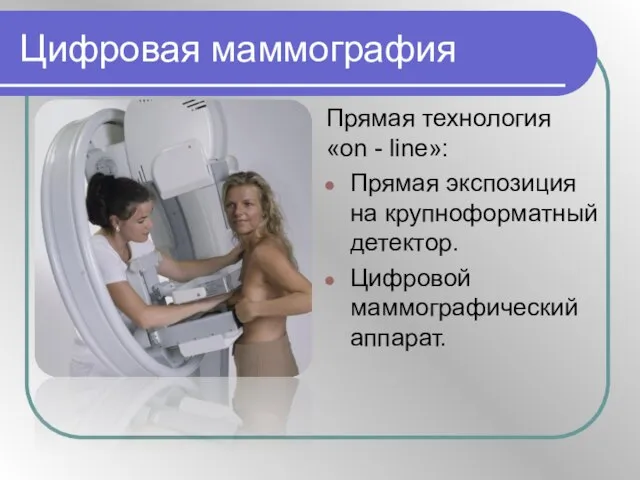 Цифровая маммография Прямая технология «on - line»: Прямая экспозиция на крупноформатный детектор. Цифровой маммографический аппарат.