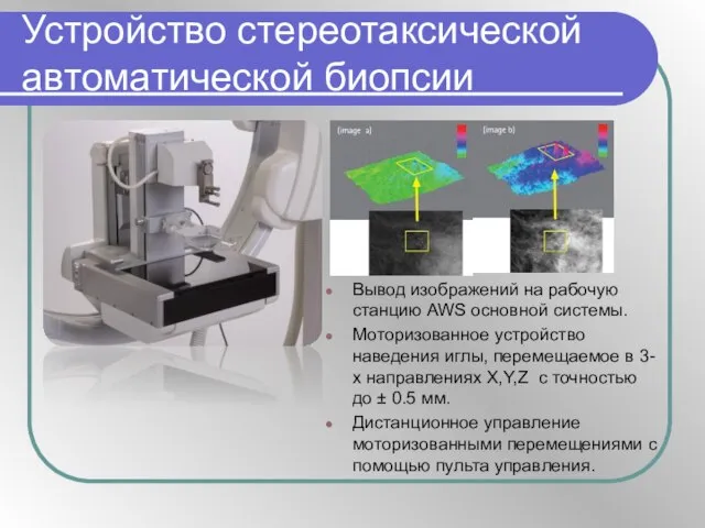 Устройство стереотаксической автоматической биопсии Вывод изображений на рабочую станцию AWS основной