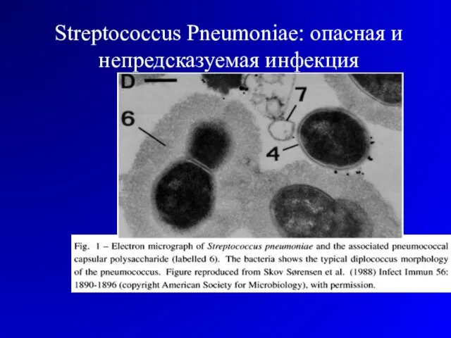 Streptococcus Pneumoniae: опасная и непредсказуемая инфекция