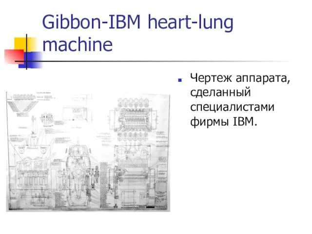 Gibbon-IBM heart-lung machine Чертеж аппарата, сделанный специалистами фирмы IBM.