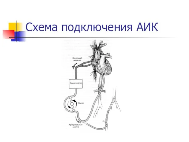 Схема подключения АИК