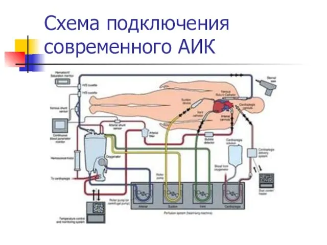 Схема подключения современного АИК