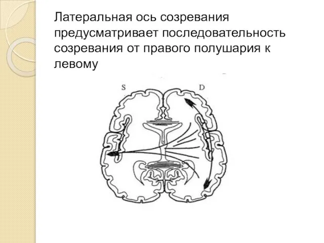 Латеральная ось созревания предусматривает последовательность созревания от правого полушария к левому