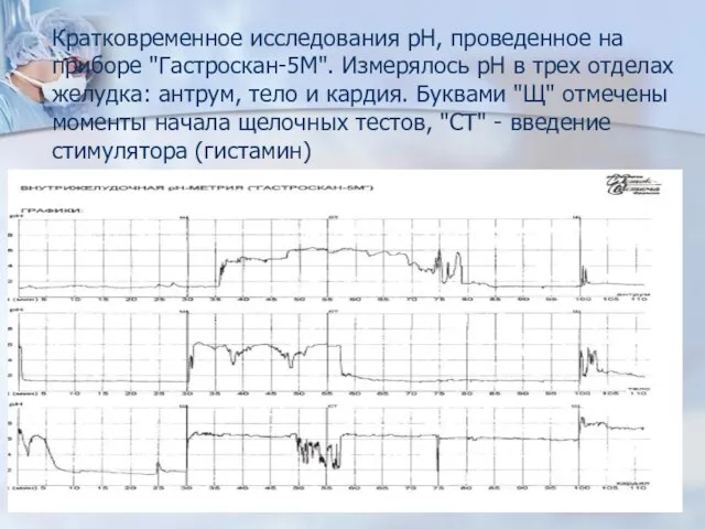 Кратковременное исследования рН, проведенное на приборе "Гастроскан-5М". Измерялось рН в трех