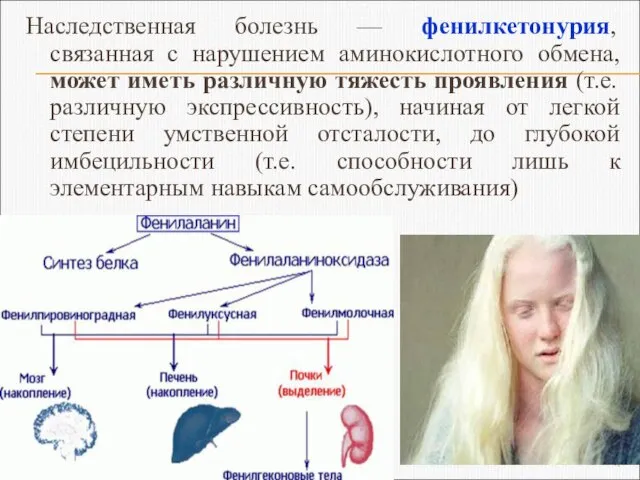 Наследственная болезнь — фенилкетонурия, связанная с нарушением аминокислотного обмена, может иметь