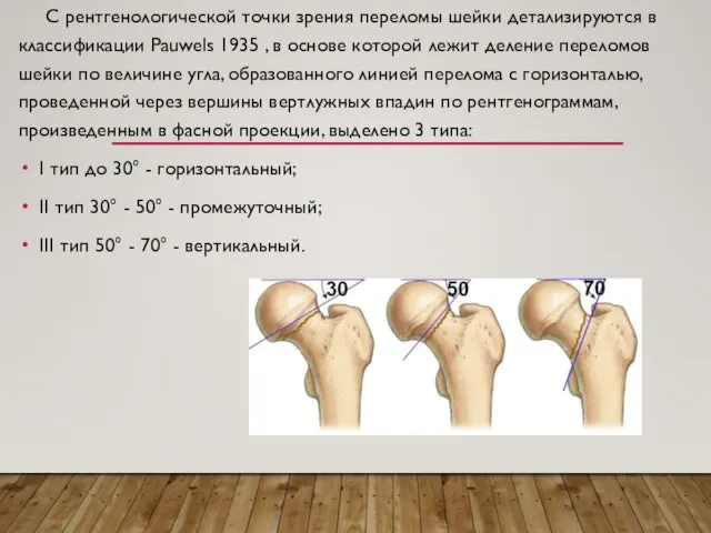 С рентгенологической точки зрения переломы шейки детализируются в классификации Pauwels 1935