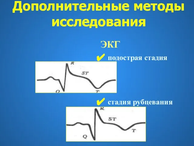 ЭКГ подострая стадия стадия рубцевания Дополнительные методы исследования