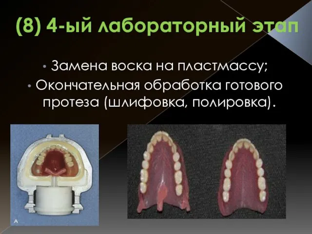 (8) 4-ый лабораторный этап Замена воска на пластмассу; Окончательная обработка готового протеза (шлифовка, полировка).