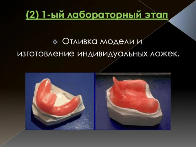 (2) 1-ый лабораторный этап Отливка модели и изготовление индивидуальных ложек.