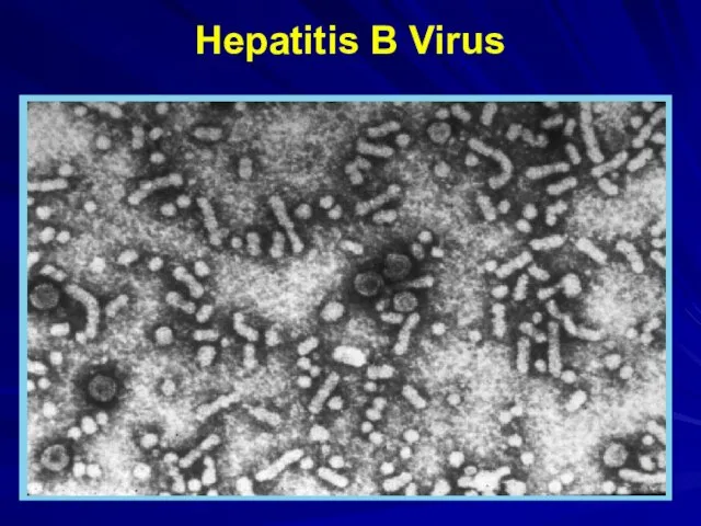 Hepatitis B Virus