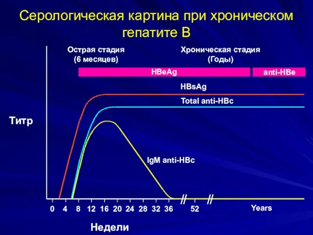 Серологическая картина при хроническом гепатите В IgM anti-HBc Total anti-HBc HBsAg