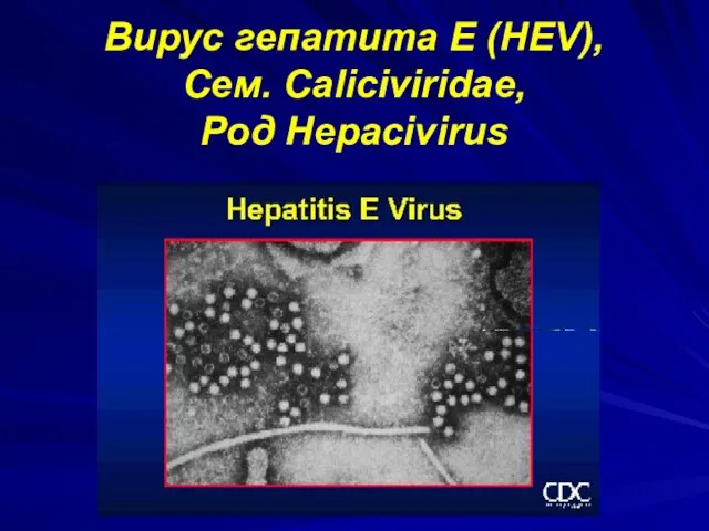 Вирус гепатита E (HEV), Сем. Сaliciviridae, Рoд Hepacivirus