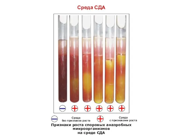 Среда СДА Cреда без признаков роста Среда с признаками роста Признаки