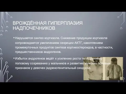 ВРОЖДЁННАЯ ГИПЕРПЛАЗИЯ НАДПОЧЕЧНИКОВ Нарушается синтез кортизола. Снижение продукции кортизола сопровождается увеличением